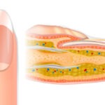 Definition des Nagels