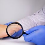 Nagelpflege für Diabetiker