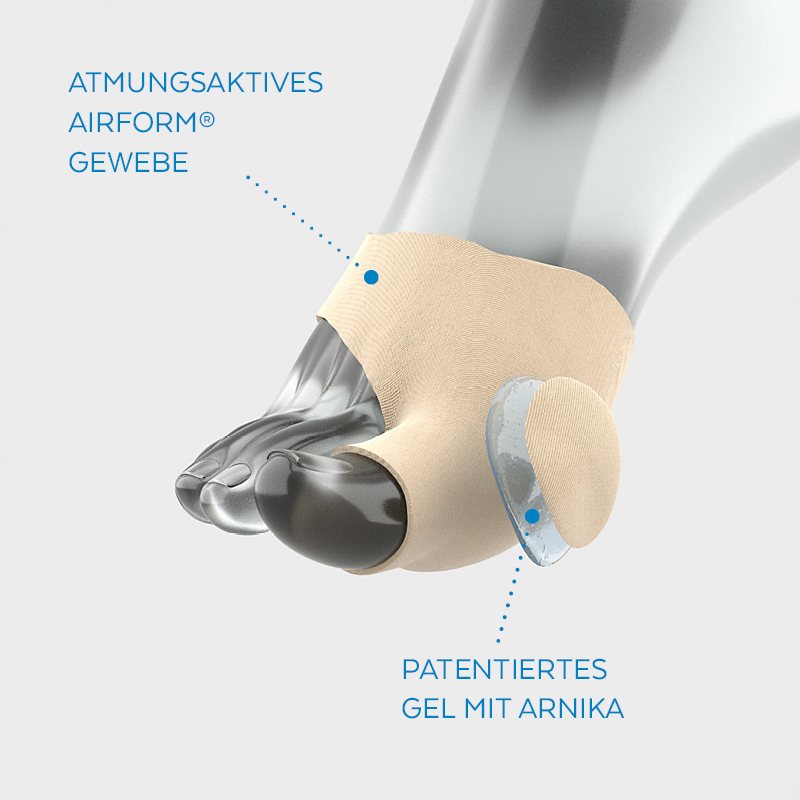 Poderm-Lösung mit Airform-Gewebe und patentiertem Arnika-Gel gegen Hallux valgus Poderm-Lösung mit Airform-Gewebe und patentiertem Arnika-Gel gegen Hallux valgus