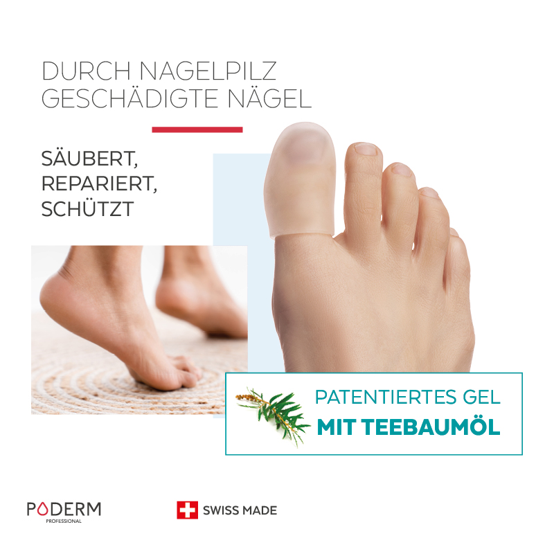 patentierte Nagelpilz-Orthese - saniert, repariert und schützt