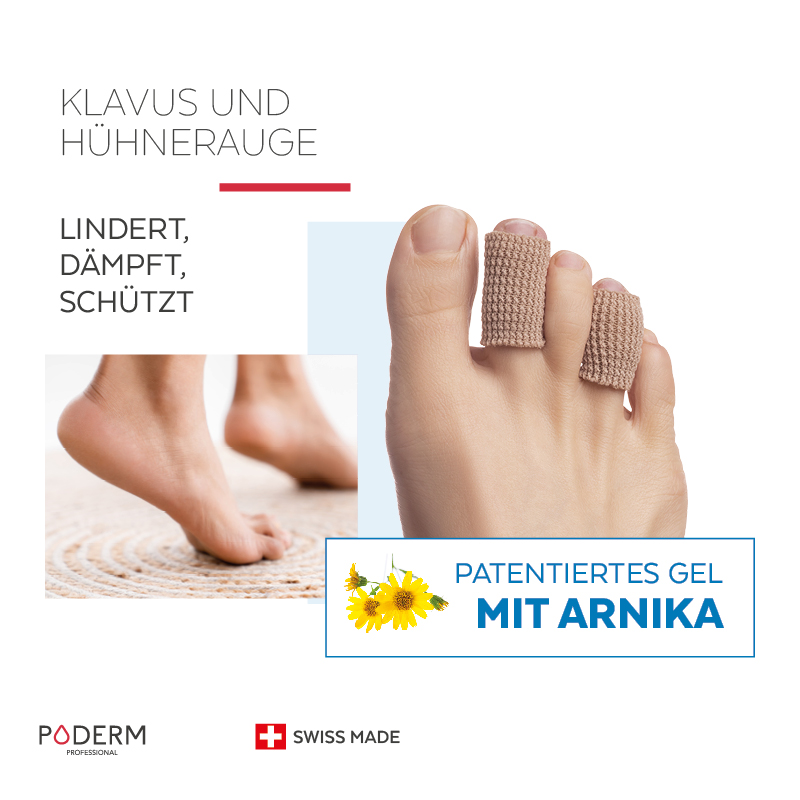 Behandlung von Hühneraugen mit dem Poderm Digitube Behandlung von Hühneraugen mit dem Poderm Digitube