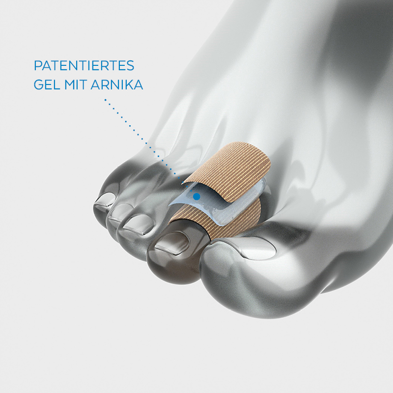 Poderm patentiertes Arnika-Gel - Hühneraugen behandeln Poderm patentiertes Arnika-Gel - Hühneraugen behandeln