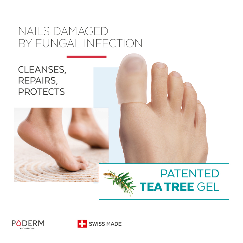 Patented fungal nail orthosis - sanitizes, repairs and protects