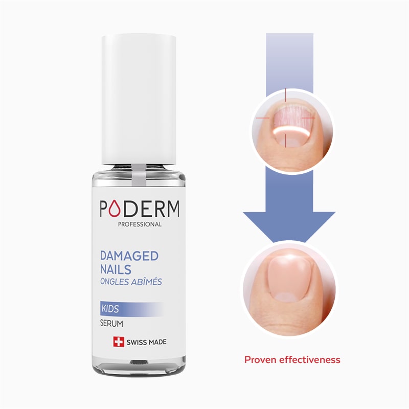 Poderm kids angle treatment for children