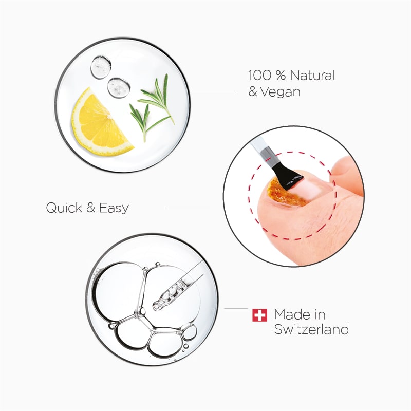 Poderm, fast and natural nail fungus treatment made in Switzerland Poderm, fast and natural nail fungus treatment made in Switzerland