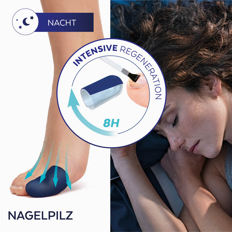 Behandelt Nagelpilz, während du schläfst. Wirkt 8 Stunden lang ununterbrochen Behandelt Nagelpilz, während du schläfst. Wirkt 8 Stunden lang ununterbrochen