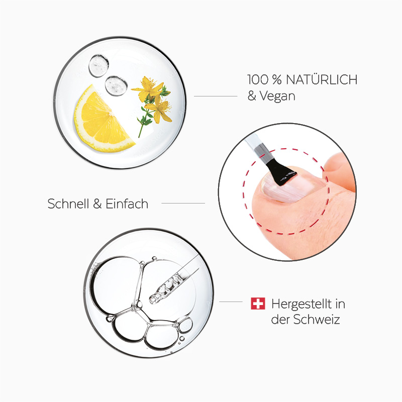 avantages-kids poderm kids gegen Nagelpilz Kind und Baby