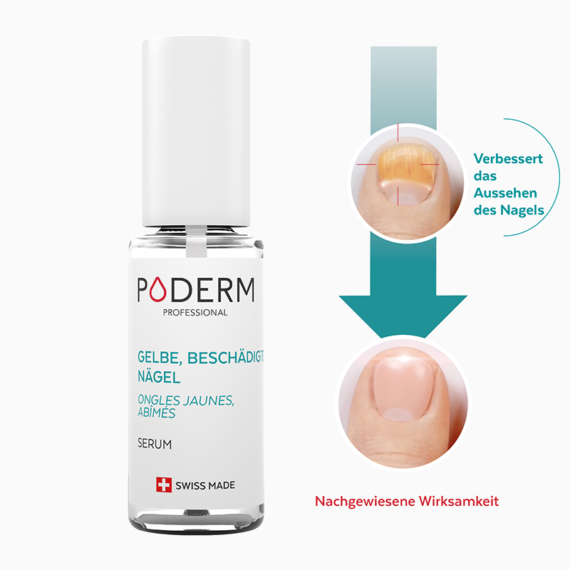 gelbe beschädigte nägel serum