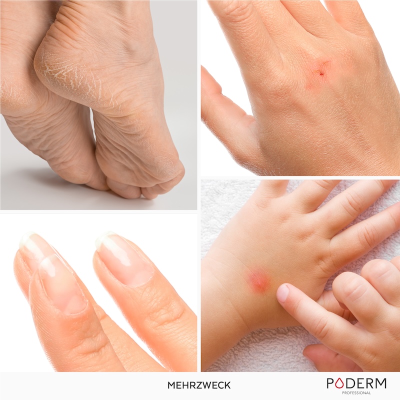 traitement-SOS-reparateur-Poderm-800px-4 copie Reparatur-SOS Verwendung