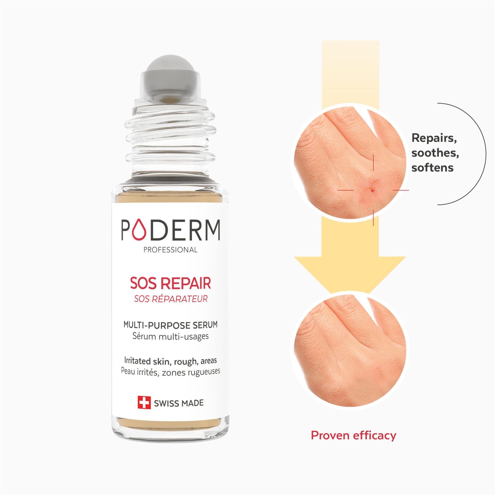 traitement-SOS-reparateur-Poderm-800px-2 copie SOS Repair application
