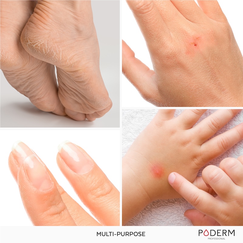 traitement-SOS-reparateur-Poderm-800px-4 copie SOS Repair use