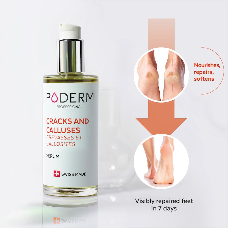 cracks and calluses serum application